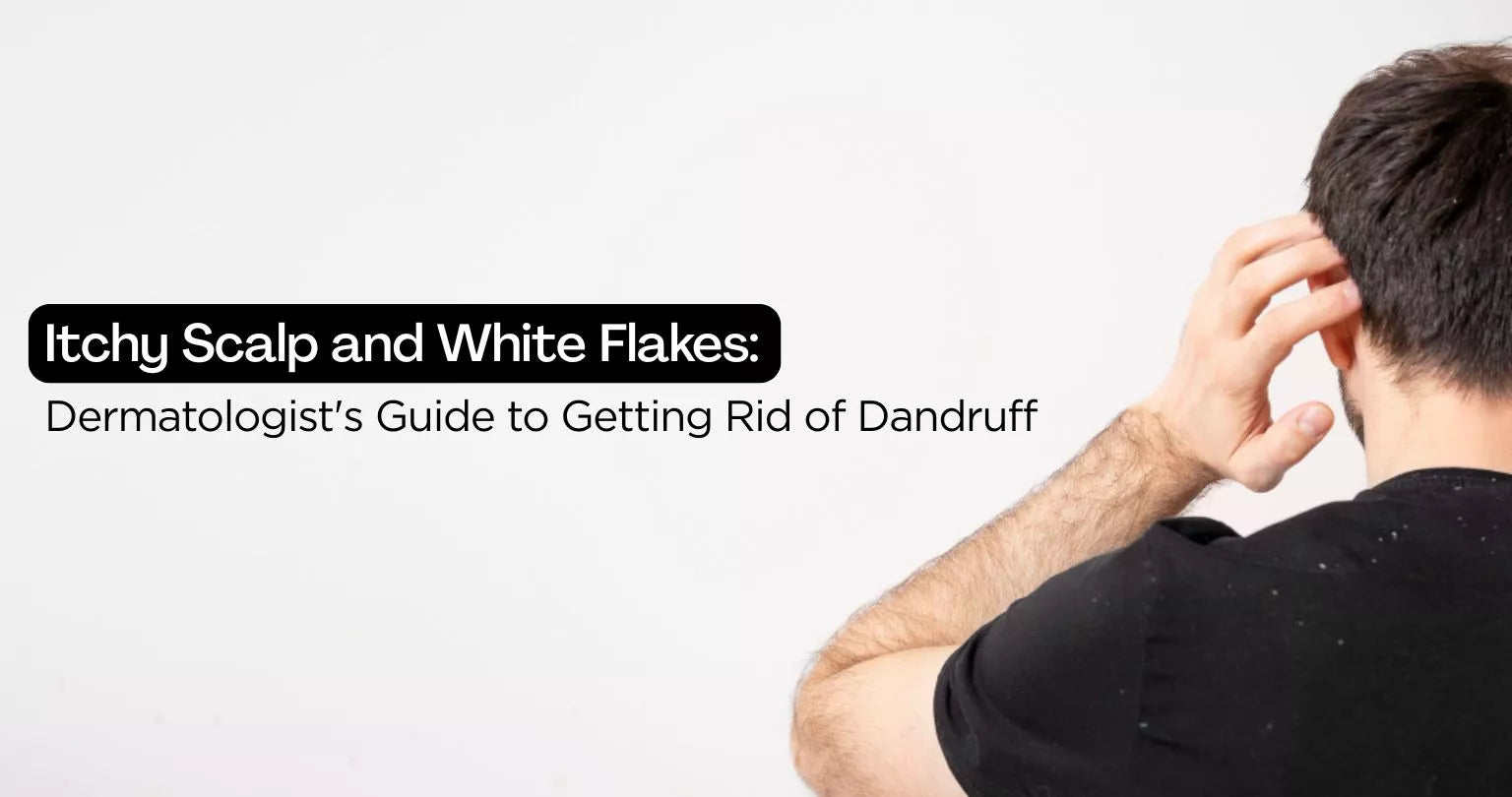 Itchy Scalp and White Flakes