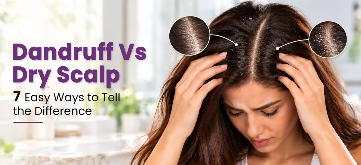 Dandruff vs Dry Scalp: 7 Easy Ways to Tell the Difference