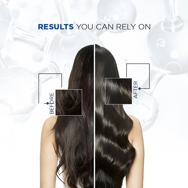 CAFFEINE SHAMPOO FOR HAIR FALL CONTROL - Trigaine