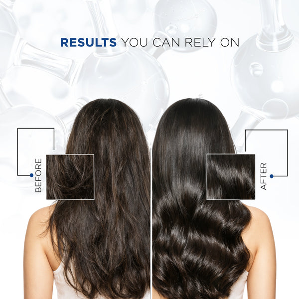 CAFFEINE SHAMPOO FOR HAIR FALL CONTROL - Trigaine