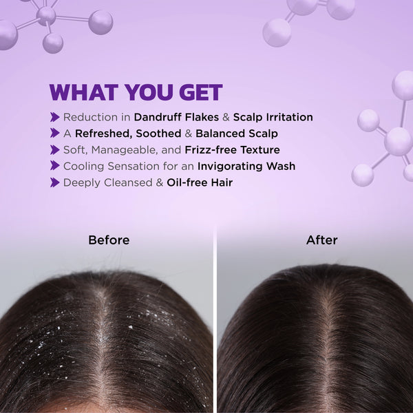 TRIGAINE PRO ANTI-DANDRUFF SHAMPOO 225 ML