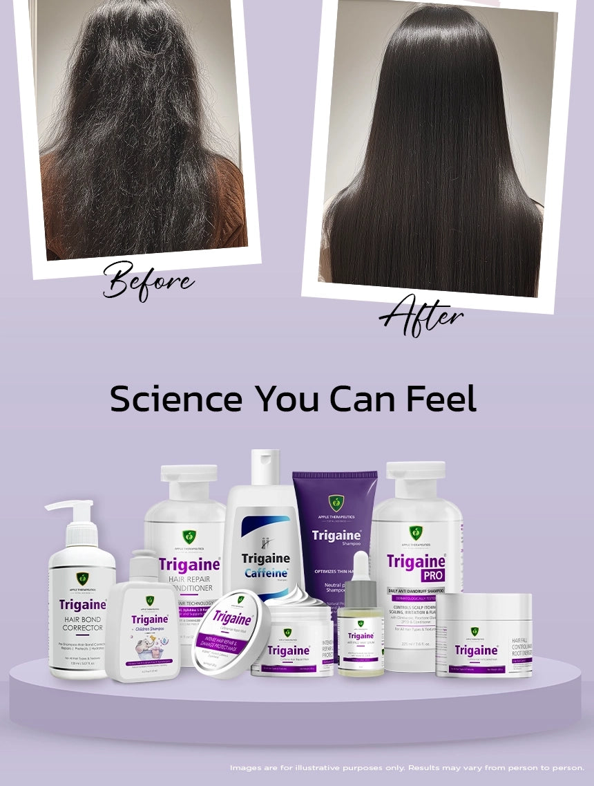 Trigaine Anti-frizz serum