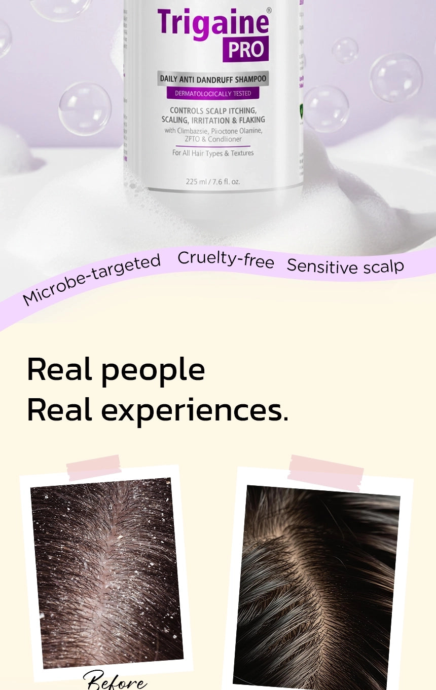 Trigaine Pro shampoo haircare