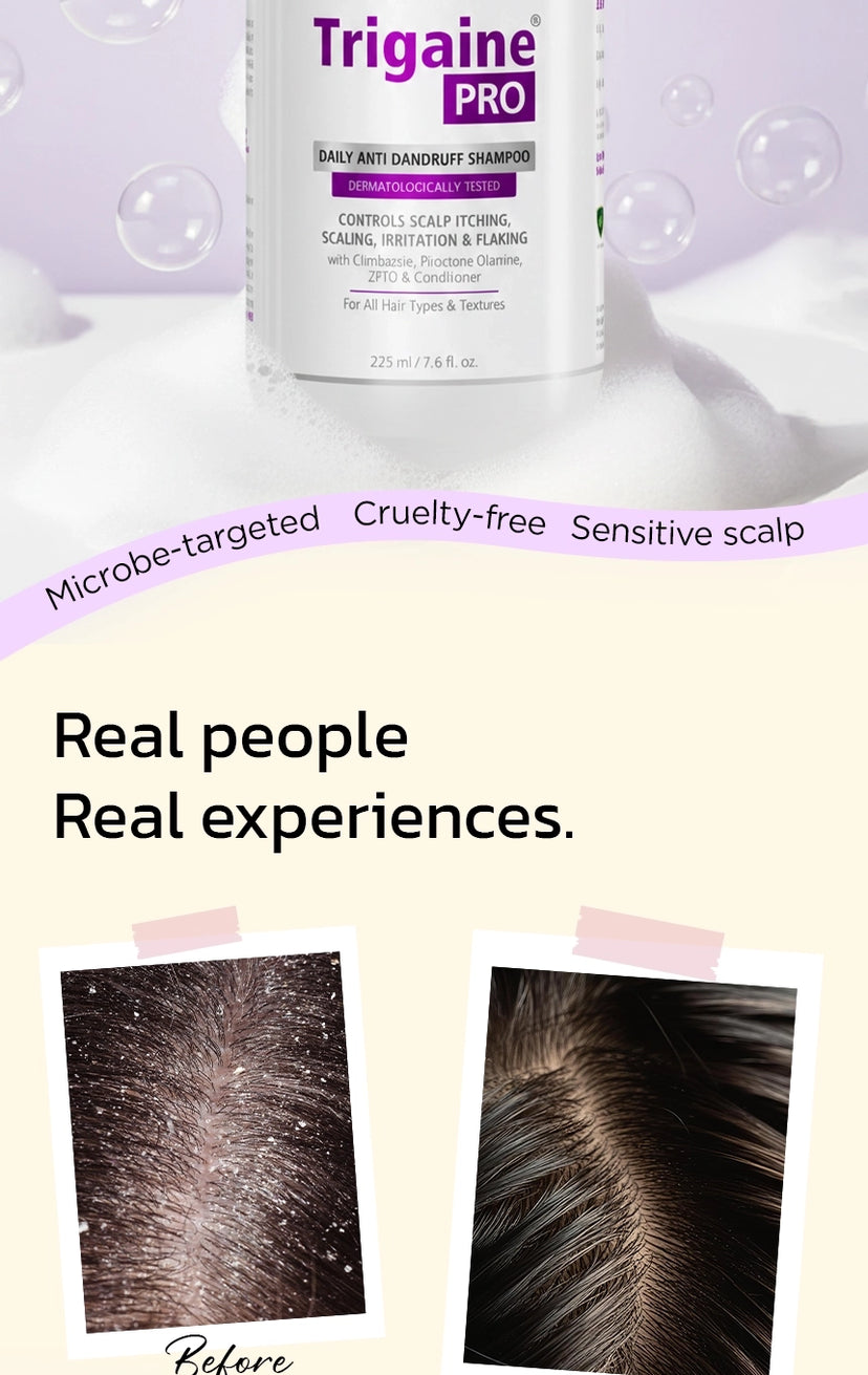Trigaine Pro shampoo haircare